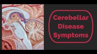 Cerebellar Disease Symptoms [upl. by Aland]