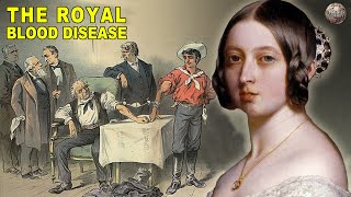 All About Hemophilia The Royal Blood Disease [upl. by Vinn]