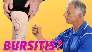 What Is Causing Your Knee Pain Bursitis How To Tell [upl. by Elysee]