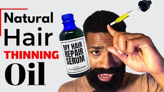 How To Apply MY Hair Repair Serum  Regrow Hairline [upl. by Ennazzus]