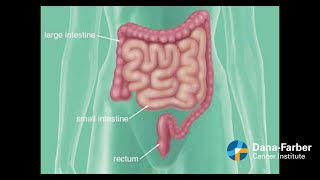 Mayo Clinic Minute When colon cancer spreads to the liver [upl. by Llezom]