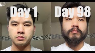 I Grew Out My Beard For 3 Months Using Minoxidil Rogaine [upl. by Neirad401]