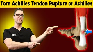 Torn Achilles Tendon Rupture or Achilles Tendonitis HOW TO TELL [upl. by Ot]