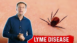 A Warning In The Last Stages Of Lyme Disease [upl. by Nayek]