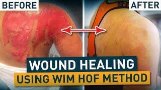 Progressive Wound Healing  Wim Hof Method [upl. by Nwaf]