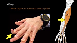 Forearm flexor muscles [upl. by Tuchman]