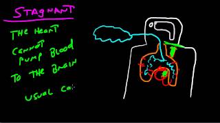 The Four Types Of Hypoxia [upl. by Asen]