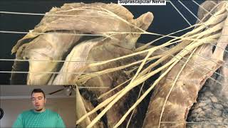 Brachial Plexus EXPLAINED Using a Cadaver [upl. by Yreme]