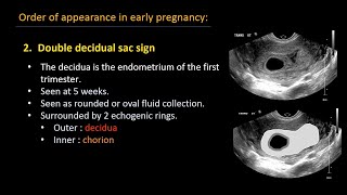 Ultrasound of normal early pregnancy [upl. by Akeber]