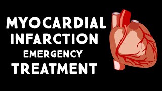 Myocardial Infarction MIHeart Attack Treatment in Emergency  Step wise STEMI Management USMLE [upl. by Meekah]