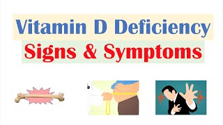 Vitamin D Deficiency Signs amp Symptoms ex Fatigue Diagnosis Treatment [upl. by Eiramrefinnej824]