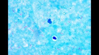 Mycobacterium under microscope afb positive [upl. by Annavaj]