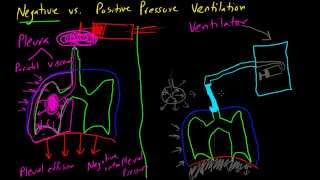 Negative vs Positive Pressure Ventilation [upl. by Aiekal782]