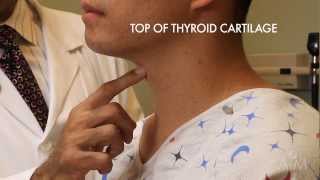 Follicular Adenoma  Thyroid Gland Histopathology [upl. by Masson]