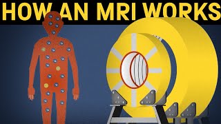 How MRI Scan is performed [upl. by Eugenie]