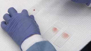 Making and staining blood smears [upl. by Nylesaj]