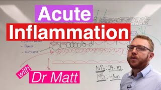 Acute Inflammation  Immunology [upl. by Katuscha]