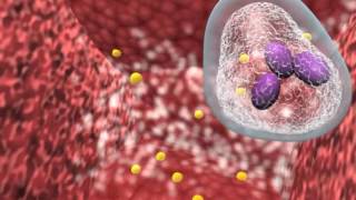 Bacterial infection and host response [upl. by Nations]