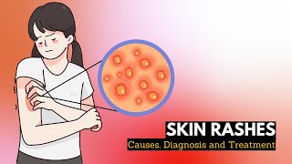 Skin Rash Causes Signs and Symptoms Diagnosis and Treatment [upl. by Enorel633]