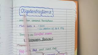 CNS Tumors  Robbins Pathology [upl. by Ilysa]