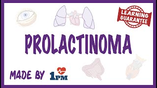 Prolactinoma  Pathology Symptoms Diagnosis Treatment [upl. by Alano]