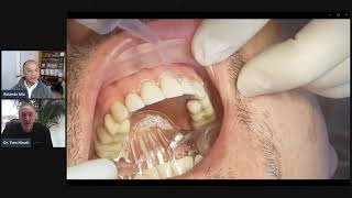 Dr Tom’s Tips – Placing Veneers With the New Isolite® Anterior Isolation System [upl. by Ytirahs]