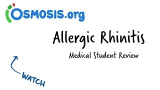 Allergic Rhinitis  Clinical Presentation [upl. by Bekah174]