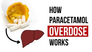 How Paracetamol Overdose Works [upl. by Annodal344]