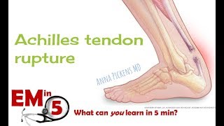 Achilles Tendon Rupture [upl. by Findlay56]