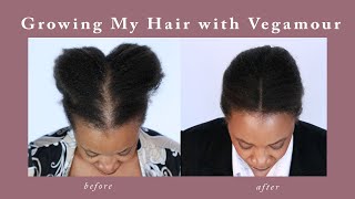 Vegamour Gro Advanced Hair Serum Results [upl. by Ecitnirp]