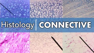 Histology  Connective Tissue [upl. by Aneertak]