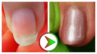 extrem eingebrochenen Nagel retten  Tutorial Nagelreparatur amp Reinigung [upl. by Raul]