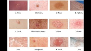 Skin Lesions with defination [upl. by Vicky109]