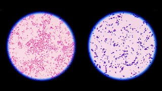 Staining technique in microbiology Gram staining [upl. by Anivla]