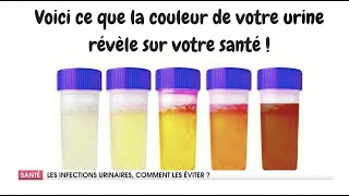 COMMENT TRAITER LES INFECTIONS URINAIRES [upl. by Aenyl576]