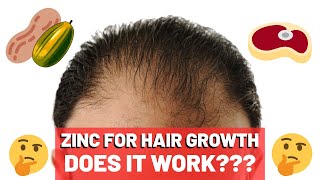 Zinc For Hair Growth  Does It WORK [upl. by Marcy]