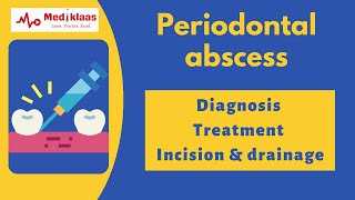 Periodontal abscess Part 2  Diagnosis and Treatment l Incision and drainage l Mediklaas [upl. by Anileuqcaj]