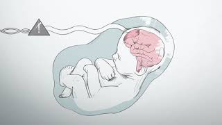 What is hypoxic ischemic encephalopathy [upl. by Yeca603]