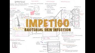 Impetigo Bacterial Skin Infection  Overview Clinical Presentation Pathophysiology Treatment [upl. by Latnahc]