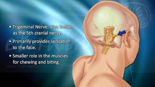 Understanding Trigeminal Neuralgia  eBrainMDcom [upl. by Narot936]