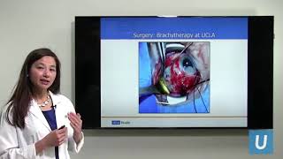 Laser Eye Surgery Procedure Video [upl. by Ydrah]