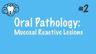 Oral Pathology  Mucosal Reactive Lesions  INBDE ADAT [upl. by Nai27]