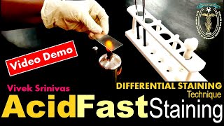 ACID FAST STAINING  Bacterial Staining Technique  Microbiology  Vivek Srinivas  Mycobacterium [upl. by Trillby]