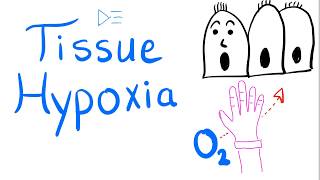 Tissue Hypoxia  Respiratory Physiology amp Pathology  Pulmonary Medicine [upl. by Bonucci]