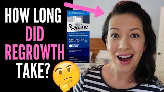 WHAT TO EXPECT WHEN STARTING ROGAINE OR MINOXIDIL HOW LONG DOES IT TAKE TO WORK And Weddings Talk [upl. by Ringo413]