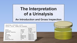 Interpretation of the Urinalysis Part 1  Introduction and Inspection [upl. by Ceil]