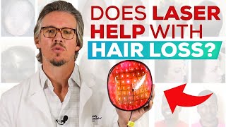 Laser Treatment For Hair Loss And Hair Regrowth Does It Work QampA [upl. by Niboc91]