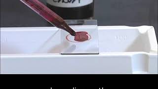 Staining technique in microbiology Acid fast staining [upl. by Nostets]