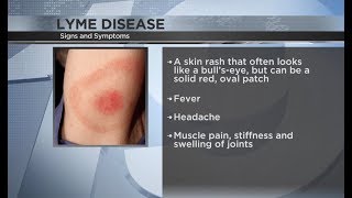 Ticks and Lyme disease [upl. by Retnyw]