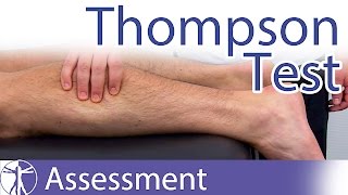 Thompson Test  Achilles Tendon RuptureTear [upl. by Gaynor]